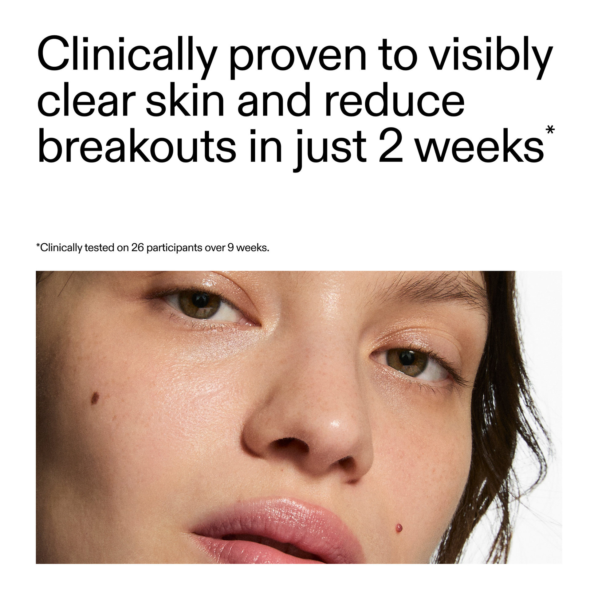 360-acne-clearing-duo-x8 360_Serum_Key_Claim.png