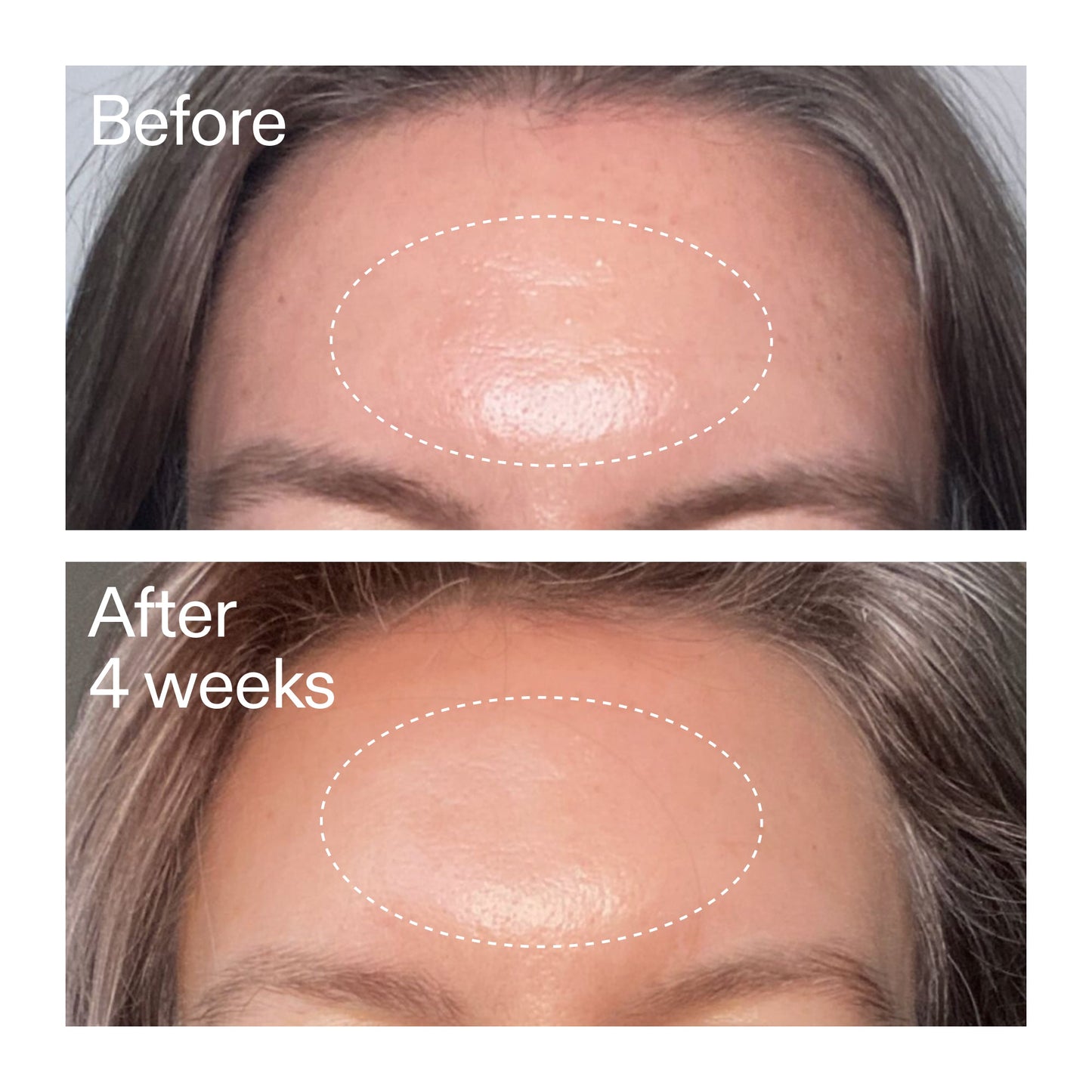 advanced-0-2-retinal-serum-s0 AdvancedRetinal_BeforeAfter1_2000x2000_1da6bb0a-29dd-41d1-95b7-8679696bbf0f.jpg