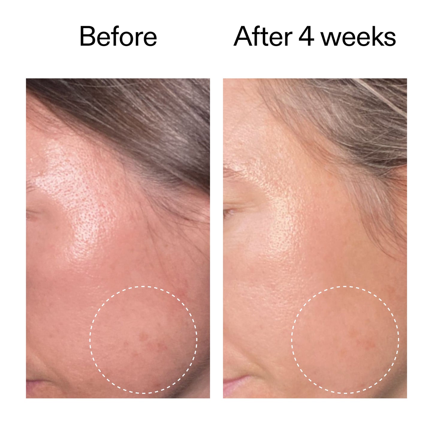 advanced-0-2-retinal-serum-duo-s5 AdvancedRetinal_BeforeAfter2__2000x2000_8ef75542-2316-4814-81ee-0f66a85912bc.jpg