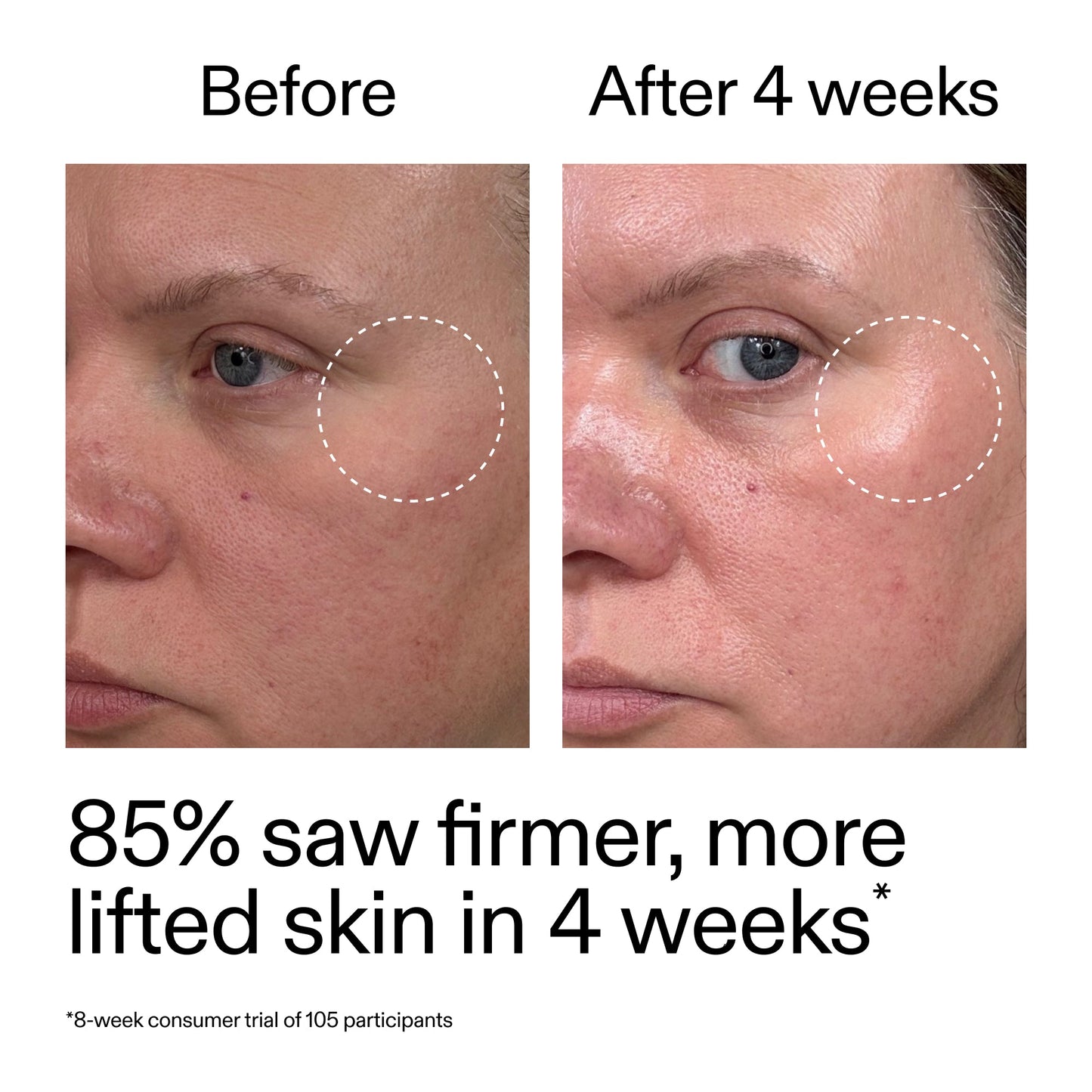 advanced-0-2-retinal-serum-s0 AdvancedRetinal_BeforeAfter_Claim1_2000x2000_bcc385c4-5e73-4f1e-aba8-64267937d0d3.jpg