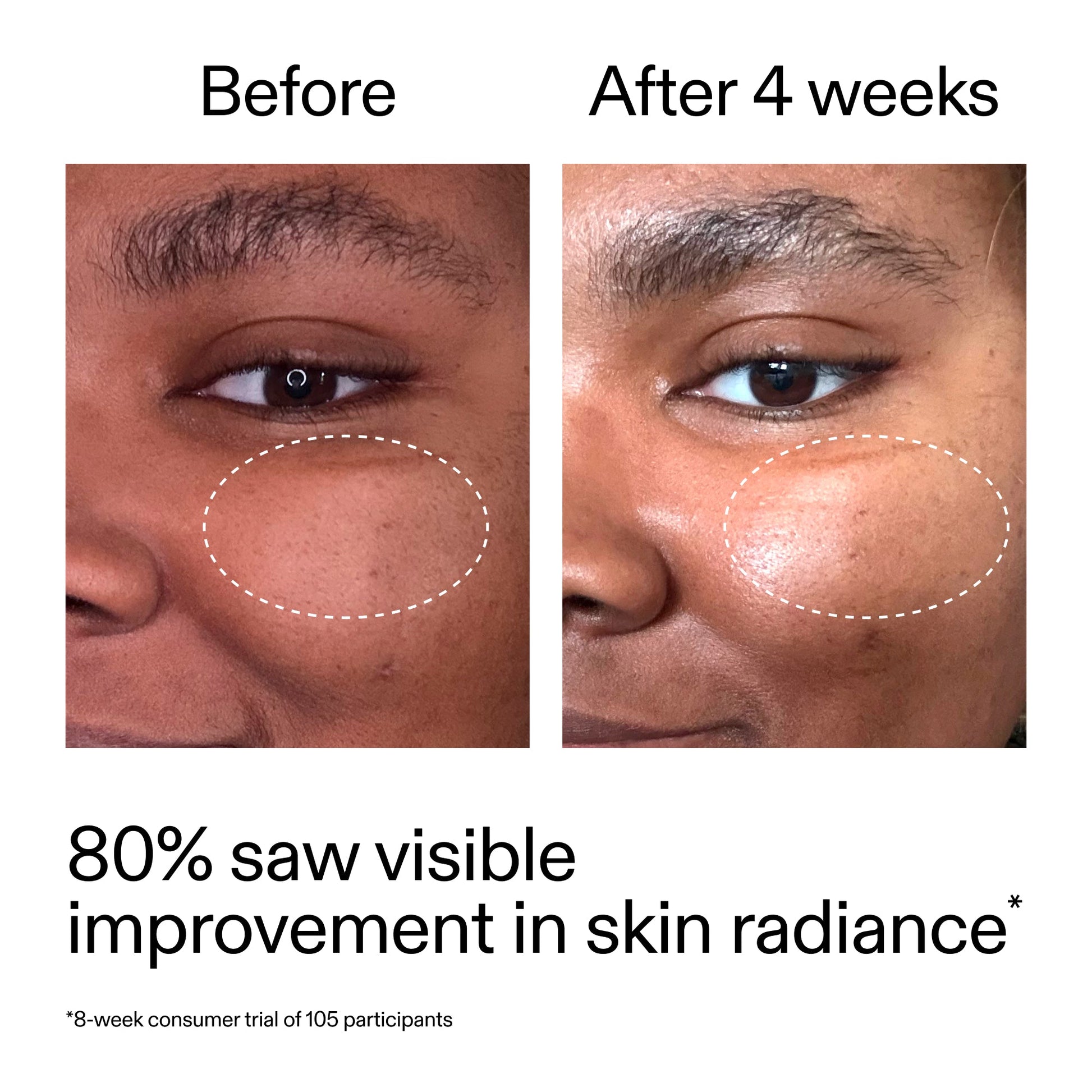 advanced-0-2-retinal-serum-s0 AdvancedRetinal_BeforeAfter_Claim2_2000x2000_39d11e3d-eda9-44ec-ab32-2903b1a368bd.jpg