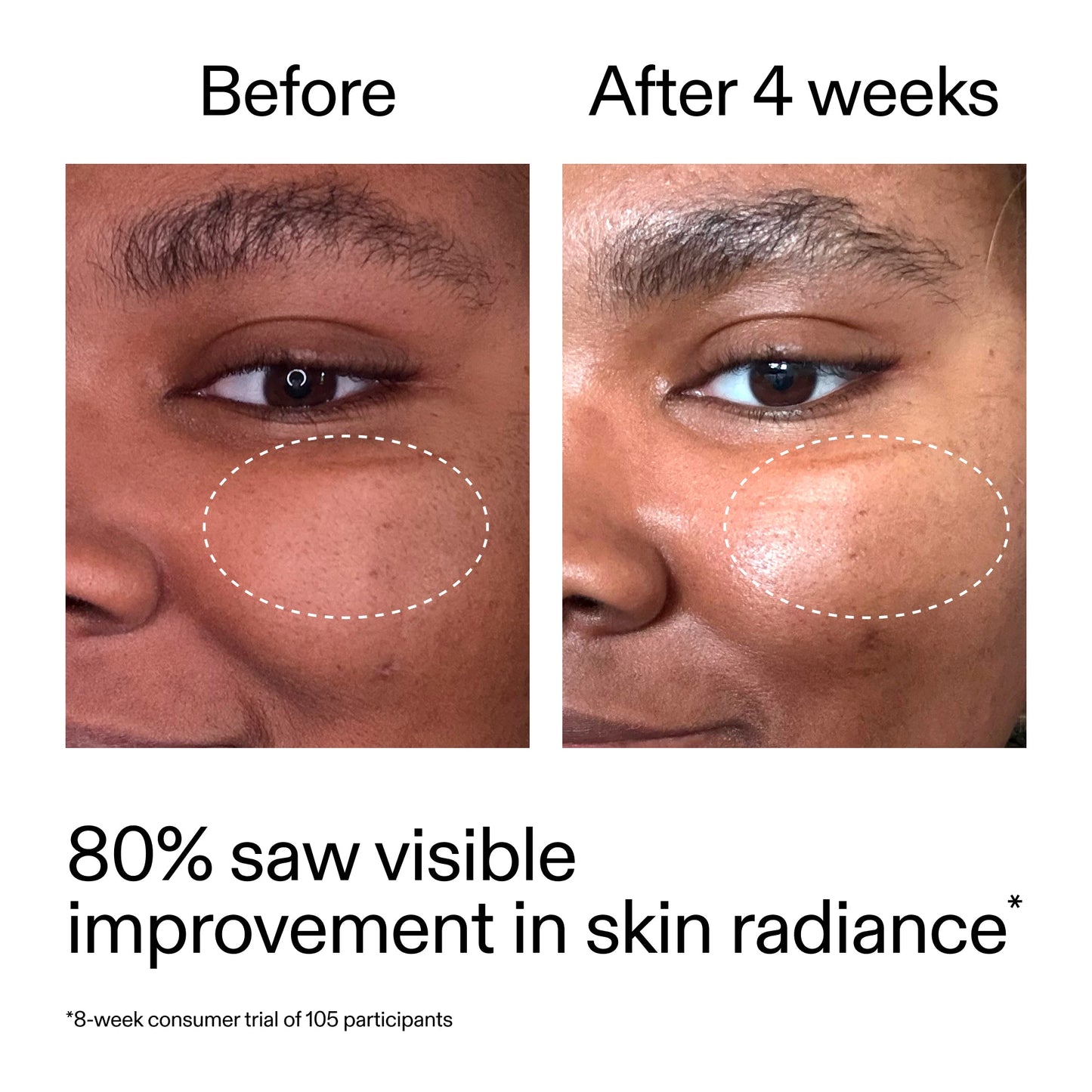 advanced-0-2-retinal-serum-duo-s5 AdvancedRetinal_BeforeAfter_Claim2_2000x2000_681b621d-8d44-4d44-9a40-89244f9b2e53.jpg