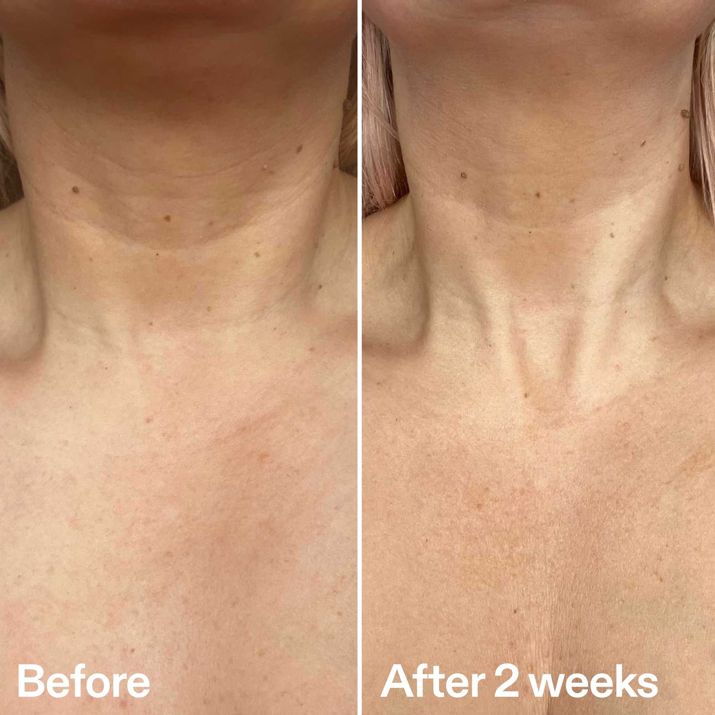 bio-active-neck-lift-stick-g6 B_A_2.jpg