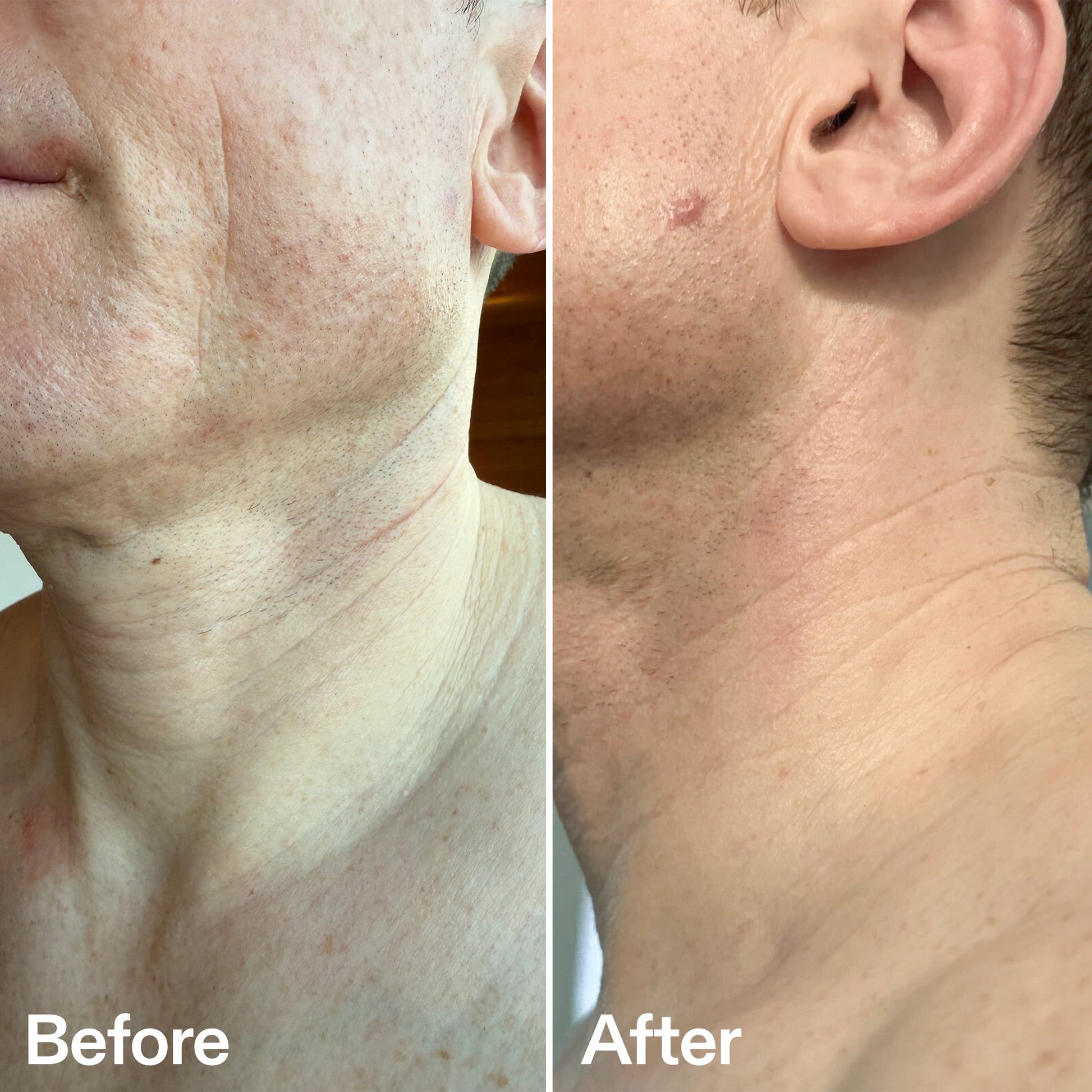 bio-active-neck-lift-stick-g6 B_A_afa2743e-b8e2-4504-92f4-e281cb6cf759.jpg