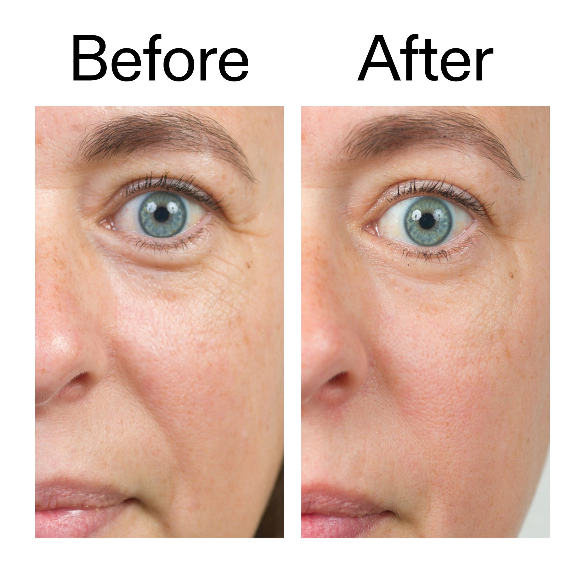 bio-active-ceramide-moisturizer-duo-h0 Bio-Active_Before_After_2000x2000_566e5a9e-135e-417a-8242-b44e5fa35463.jpg