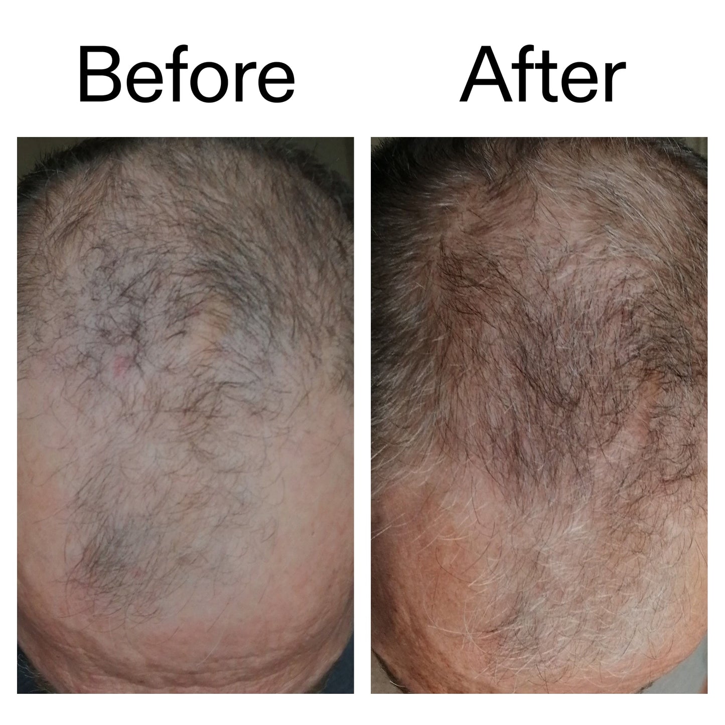caffeine-stimulating-scalp-treatment-v4 Caffeine_Scalp_Treatment_B_A_Ppage_2000_x_2000.jpg