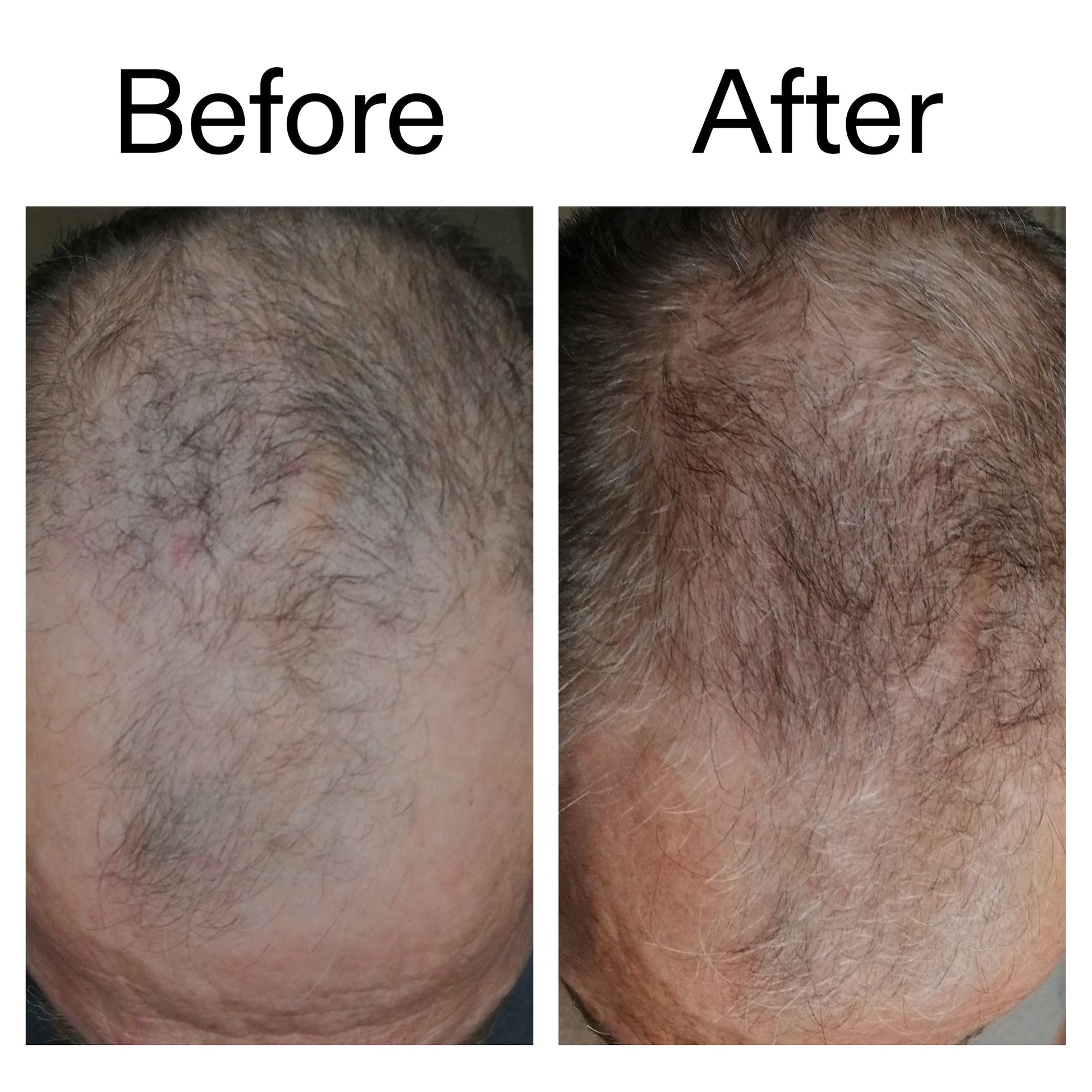 caffeine-stimulating-scalp-treatment-v4 Caffeine_Scalp_Treatment_B_A_Ppage_2000_x_2000.jpg