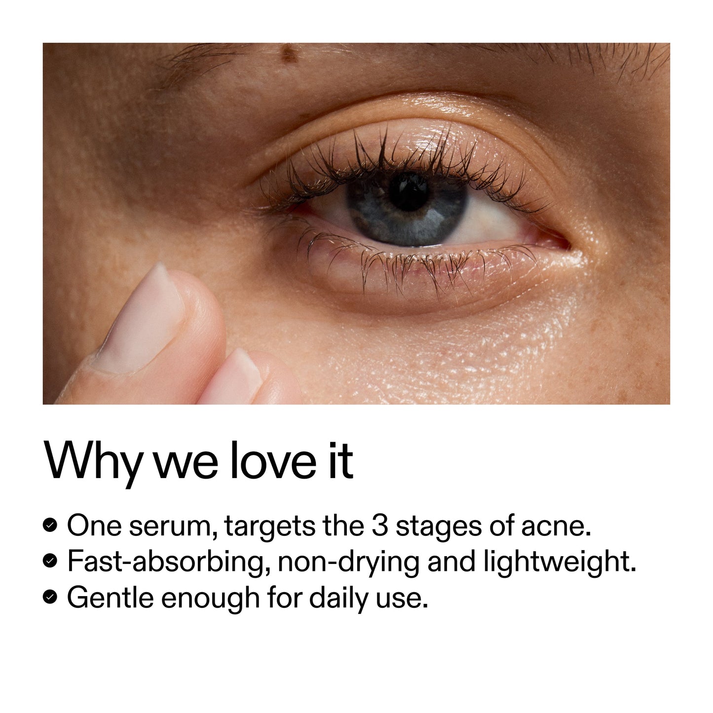 360-acne-clearing-duo-x8 Dioic_Whyweloveit_2000x2000_175aafd3-0cbe-403a-b317-a8362881bfe2.jpg