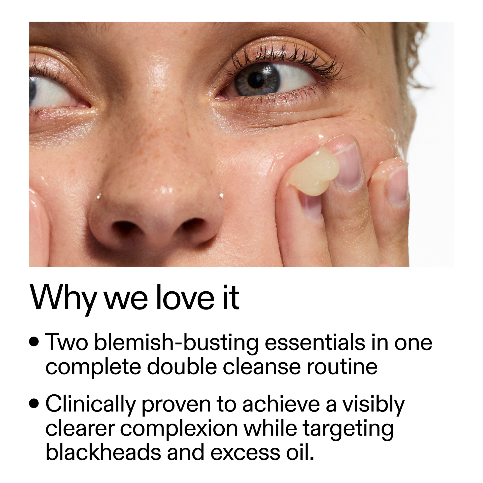 acne-double-cleanse-duo-h4 Double_Cleanse_Duo_for_Breakouts_Why_We_2000x2000_f242cb12-bb5c-487c-b203-071ccb406ec5.png