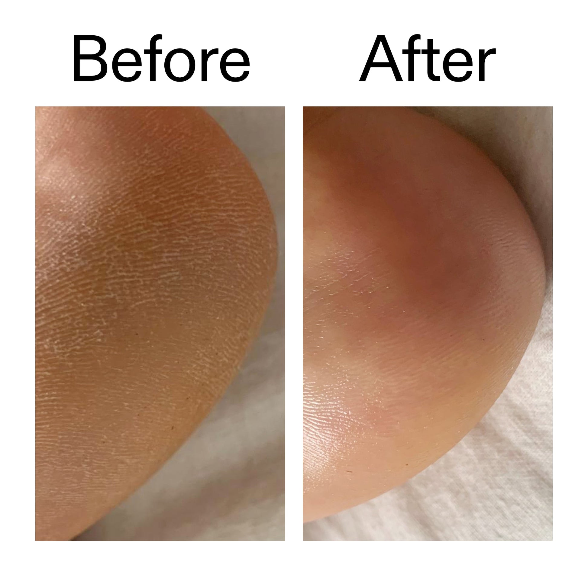 glycolic-acid-exfoliating-body-stick-g5 Glycolic_Acid_Exfoliating_Body_Stick_Before_After_V1_2000x2000_a3043625-9400-429a-a7fb-d6dbd220f722.jpg