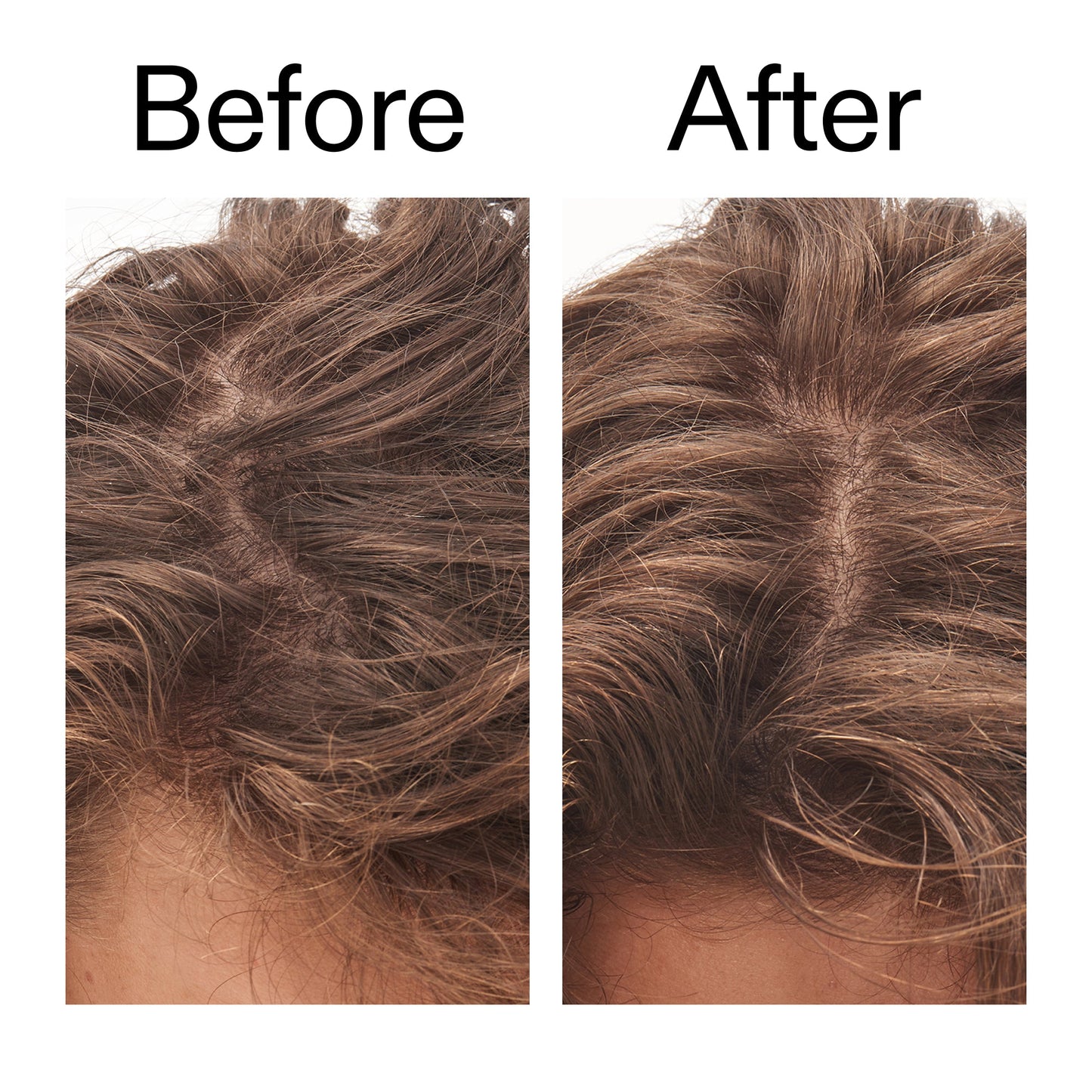 glycolic-acid-exfoliating-scalp-scrub-p7 Glycolic_Acid_Exfoliating_Scalp_Scrub_Before_After_2000x2000_b8561c87-05a1-4caa-80f7-1b6b33d750f7.jpg