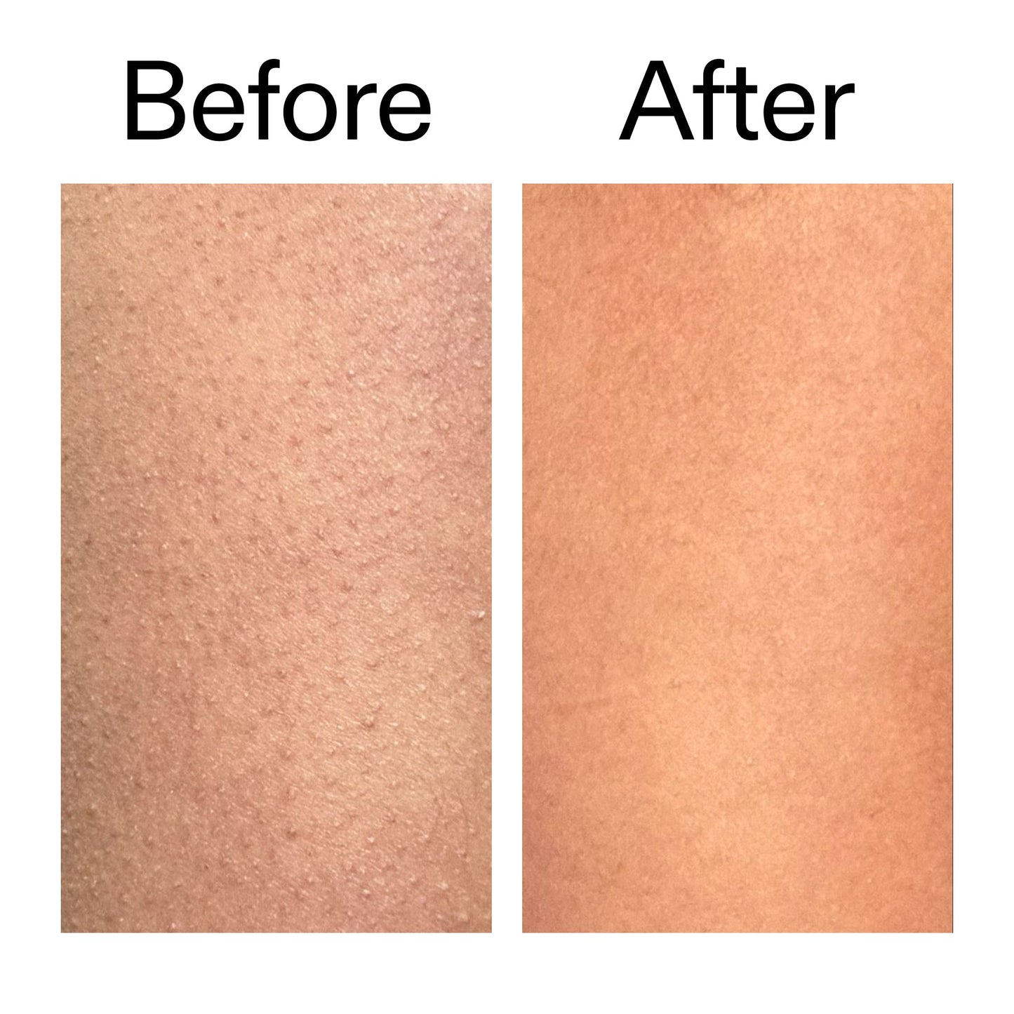 glycolic-acid-exfoliating-body-stick-duo-t6 Glycolic_Body_Stick_B_A_2000x2000_6e6e6b4d-5bd7-43c0-aeed-4d66788e8995.jpg