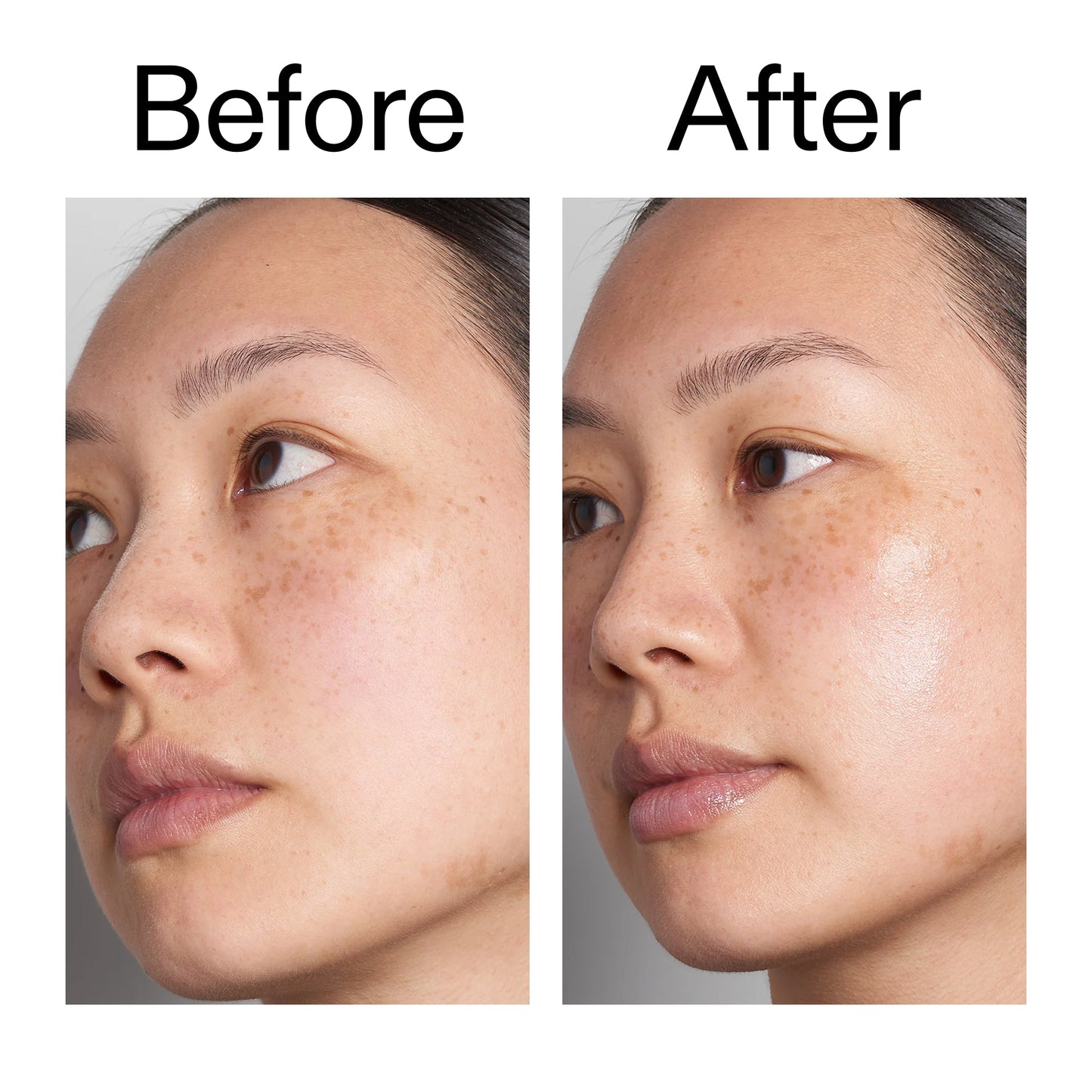 hyaluronic-acid-serum-30ml-n8 Hyaluronic_Acid_Before_After_2000x2000_d7983956-8aa2-4ea3-8255-c63e8d4f892e.jpg