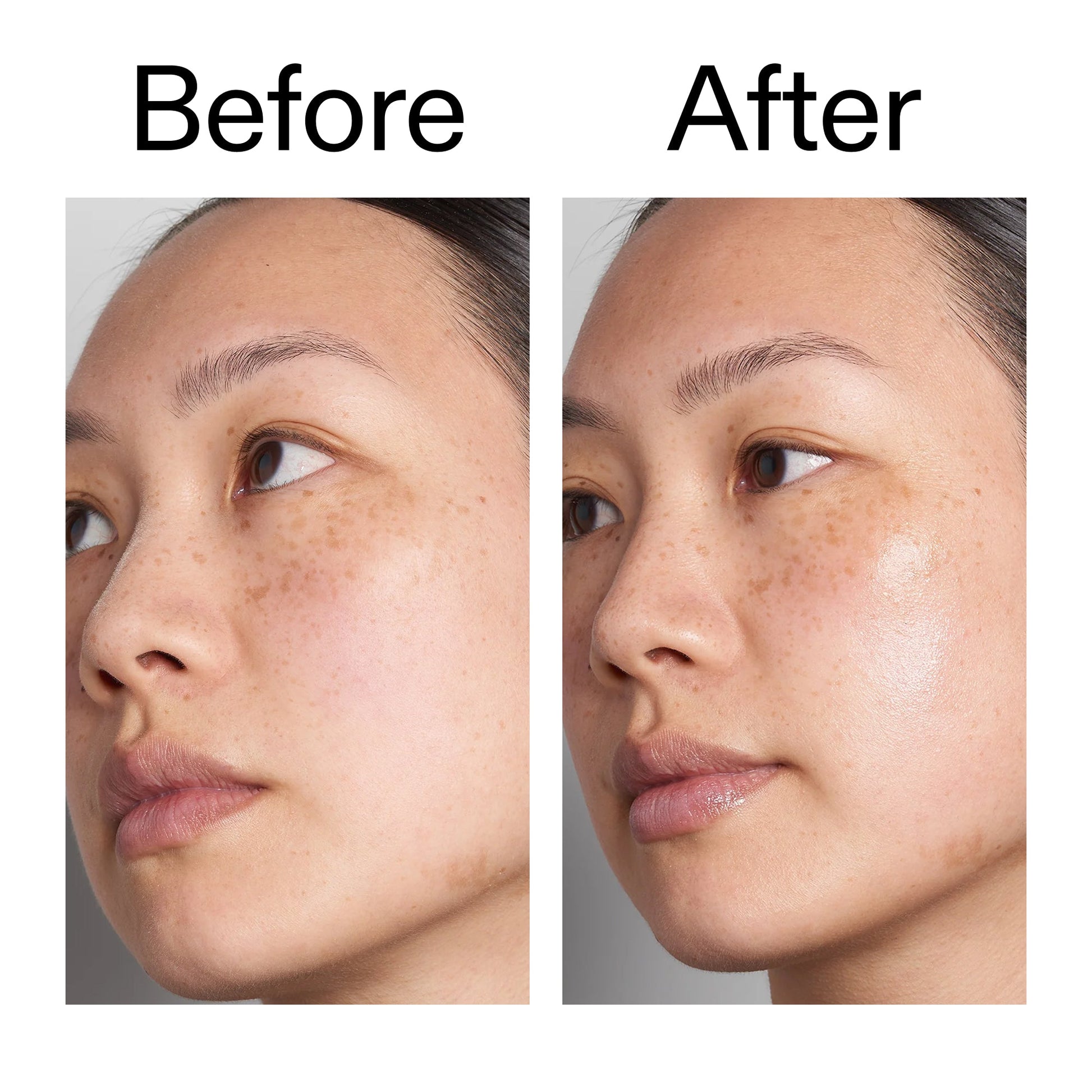 hyaluronic-acid-serum-60ml-duo-z0 Hyaluronic_Acid_Before_After_2000x2000_d566f5ba-a77e-4585-99fd-0f4682b164dd.jpg