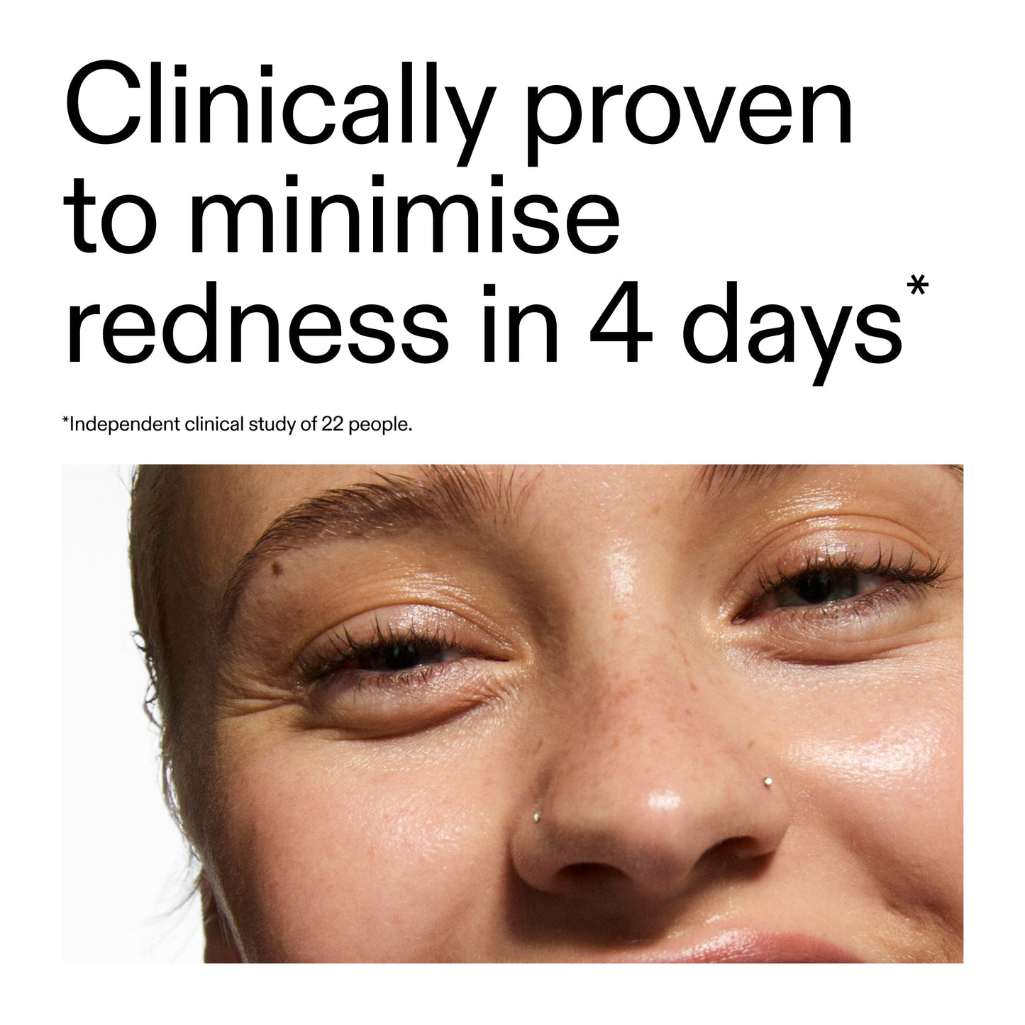 10-azelaic-acid-serum-for-redness-relief-c2 Oat_Cleansing_Balm_Claim_2000x2000_52a841dc-353c-4f2c-8646-3aadb604507d.jpg
