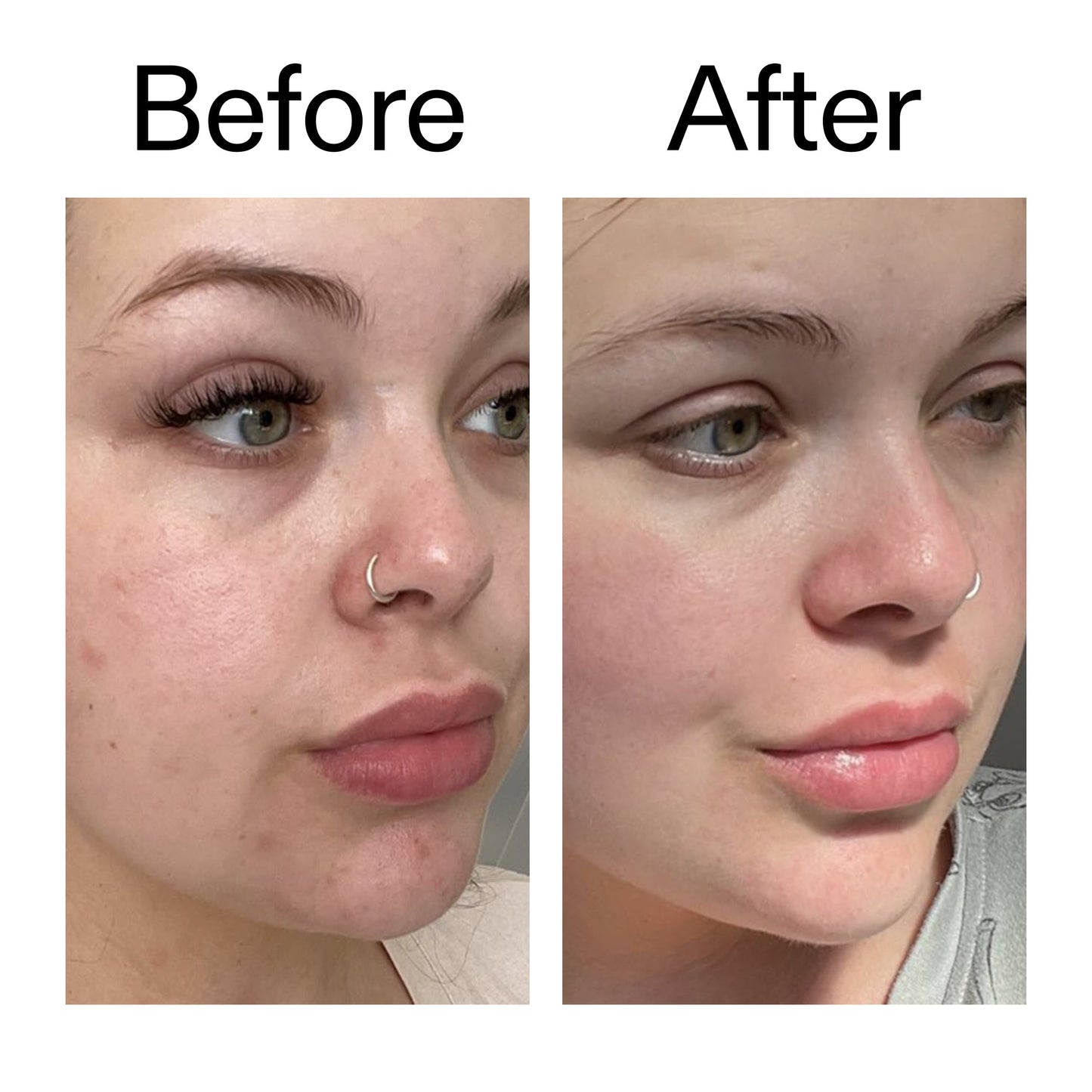 supersize-omega-water-cream-duo-u2 Omega50_Before_After_2000x2000_46483ed8-3f9d-487f-9a0c-9df79830bd65.jpg