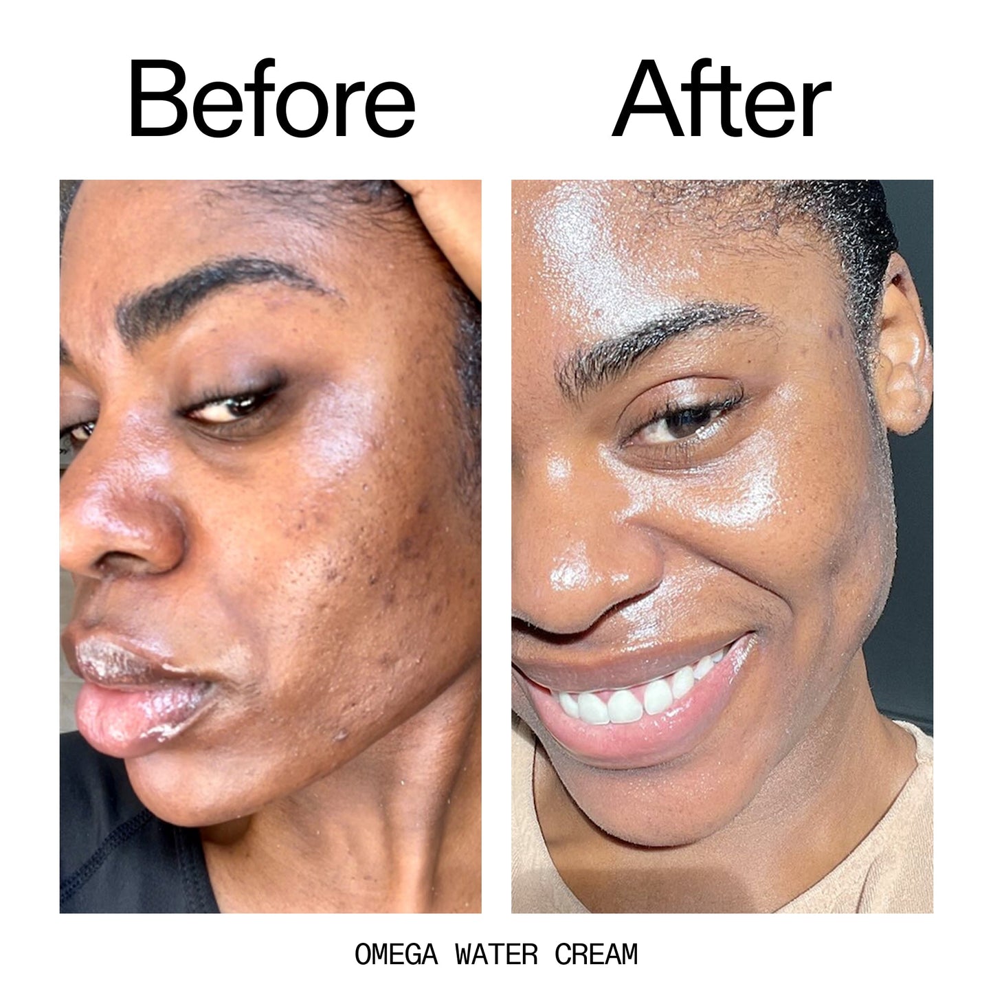 hydrating-cleanser-and-moisturizer-duo-d3 Omega_Water_Cream_Before_After_2000x2000_8e88278b-8c8d-48dc-ac77-4e98ebbd1b77.jpg