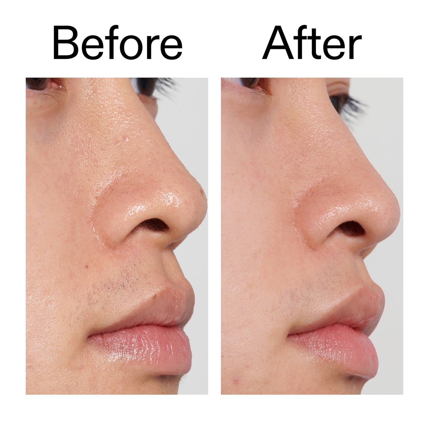 pha-toner-j9 PHA_Toner_Before_After_2000x2000_e3c10172-0150-4342-8b95-57417eaff50d.jpg