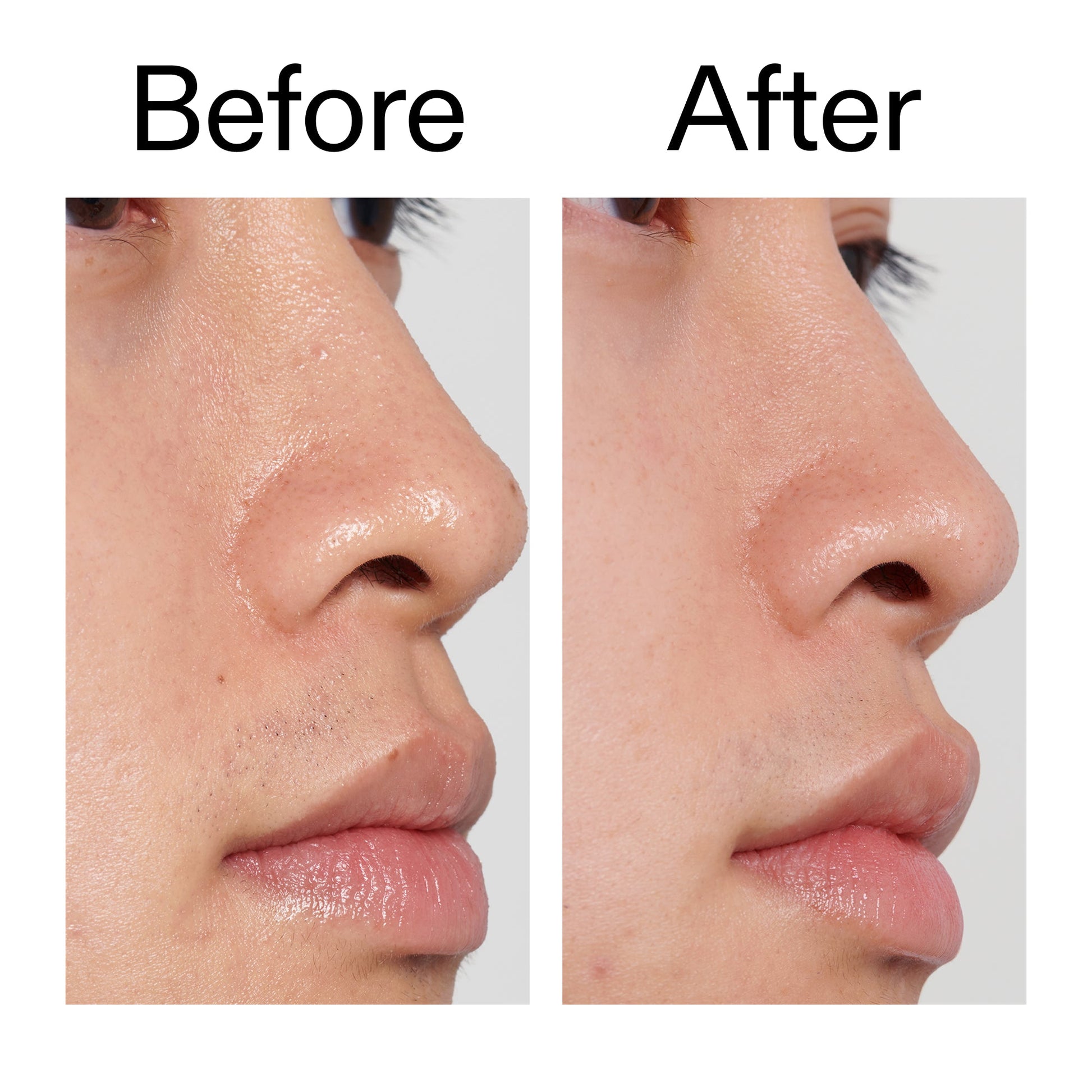 pha-toner-j9 PHA_Toner_Before_After_2000x2000_e3c10172-0150-4342-8b95-57417eaff50d.jpg