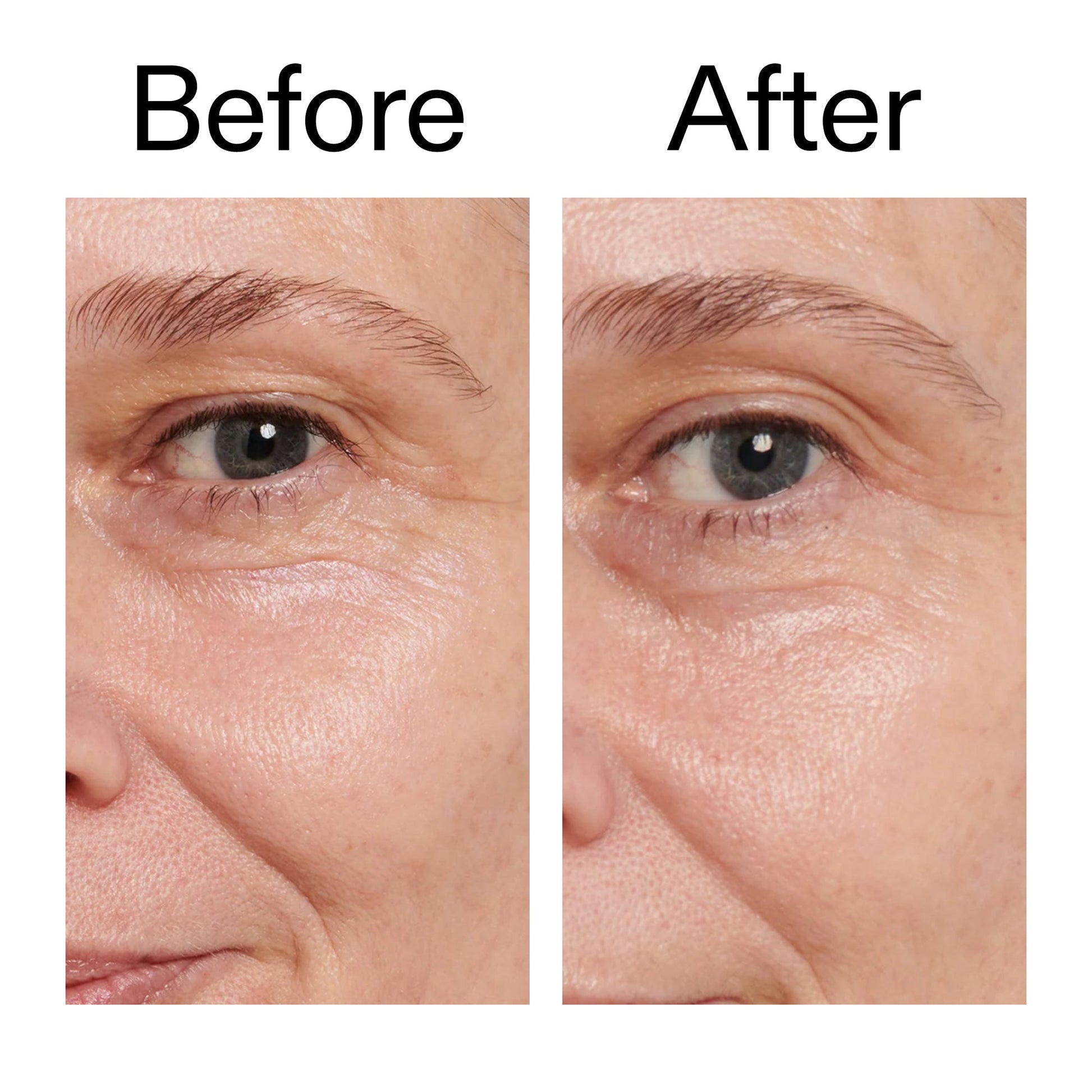 retinol-eye-cream-x6 Retinol_Eye_Cream_Before_After_2000x2000_ac03a80c-109e-4572-a95a-91dc109b4d27.jpg