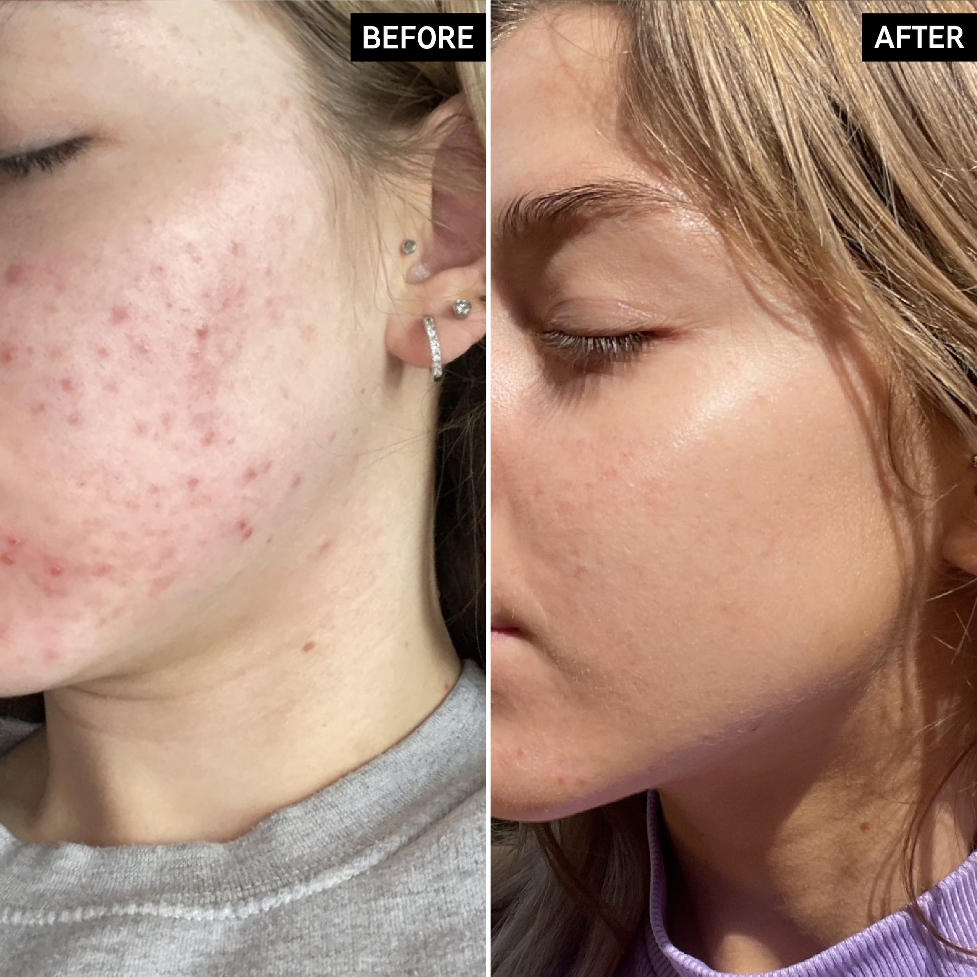 deep-cleanse-duo-a9 SITE-12xUGCB_AsforPpages_Shannon_B_A_PPage_2000x2000_db99c152-d515-471e-b6f6-8865428952cc.png