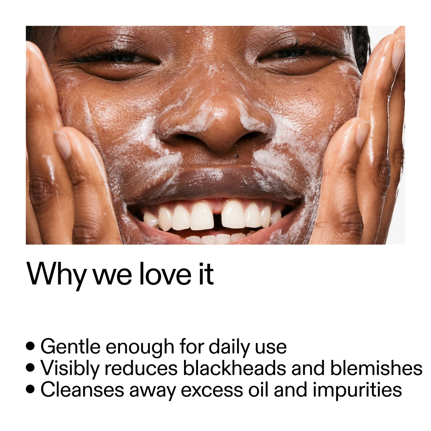 salicylic-acid-cleanser-duo-z5 Salicylic_Acid_Cleanser_-_300mlWhy_we_love_it_2000x2000_87dc92a9-2559-4309-98cd-4e570f1be735.jpg
