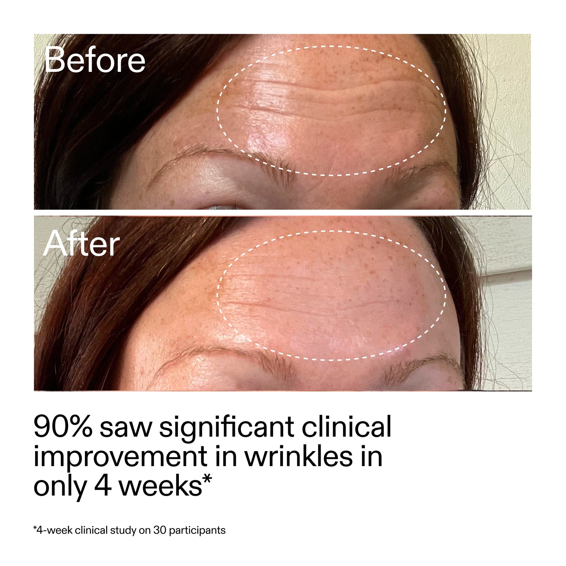 starter-retinol-serum-duo-k3 StarterRetinol_BeforeAfter_Claim1_2000x2000_03b4d6e5-a357-43b9-a855-aba5e35c57f3.jpg