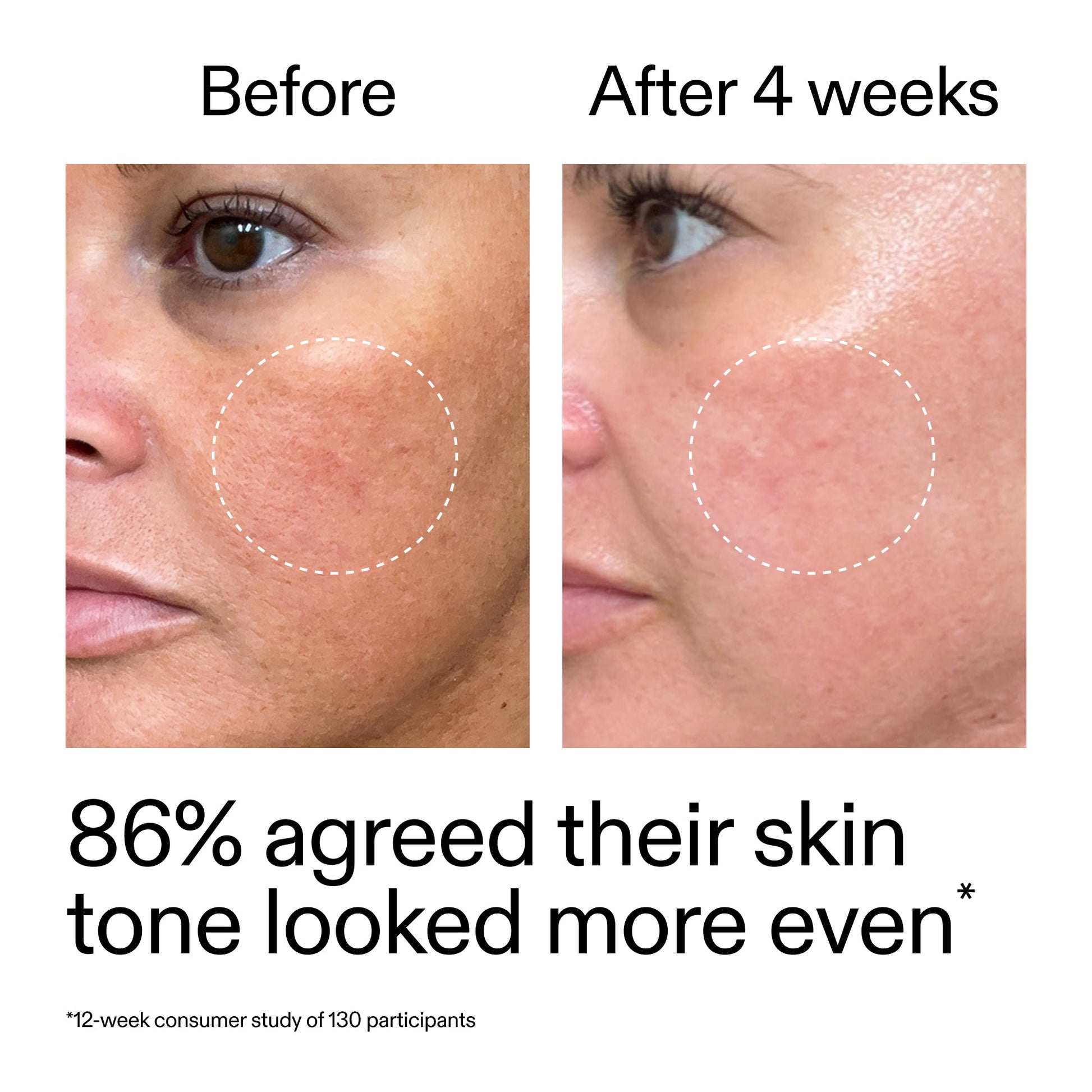starter-retinol-serum-duo-k3 StarterRetinol_BeforeAfter_Claim2_2000x2000_fc5bb8ac-8588-478f-98d5-28af6651601a.jpg