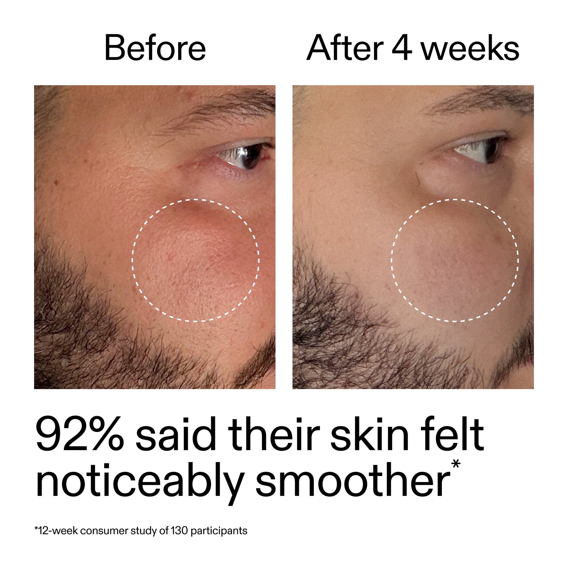 starter-retinol-serum-l6 StarterRetinol_BeforeAfter_Claim3_2000x2000_6ceab106-e0ee-4ed4-ba62-41bc39538038.jpg