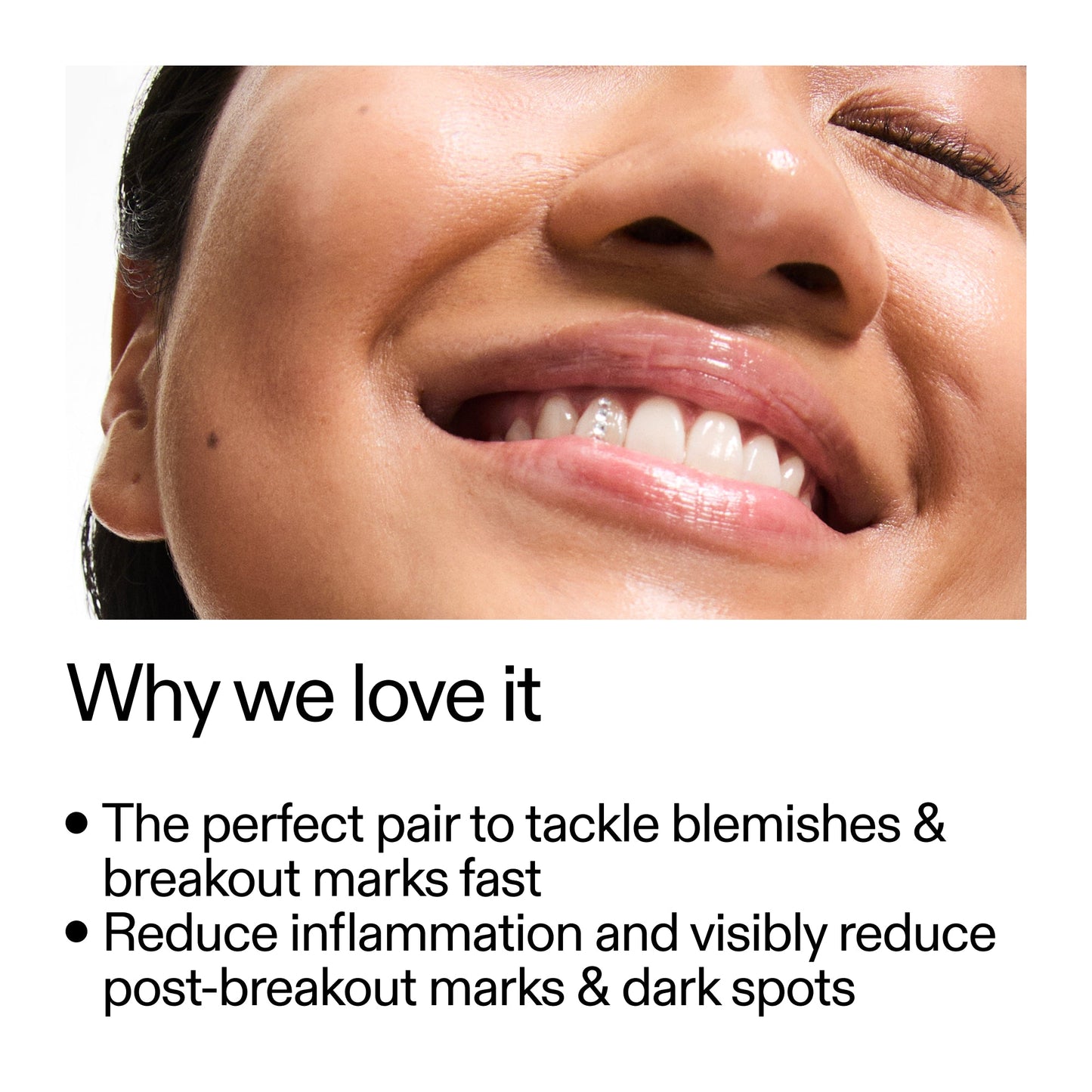 targeted-blemish-duo-w6 Targeted_Blemish_Duo_Why_we_love_it_2000x2000_ff00be46-438b-485f-b5c3-91e60bbb6919.jpg