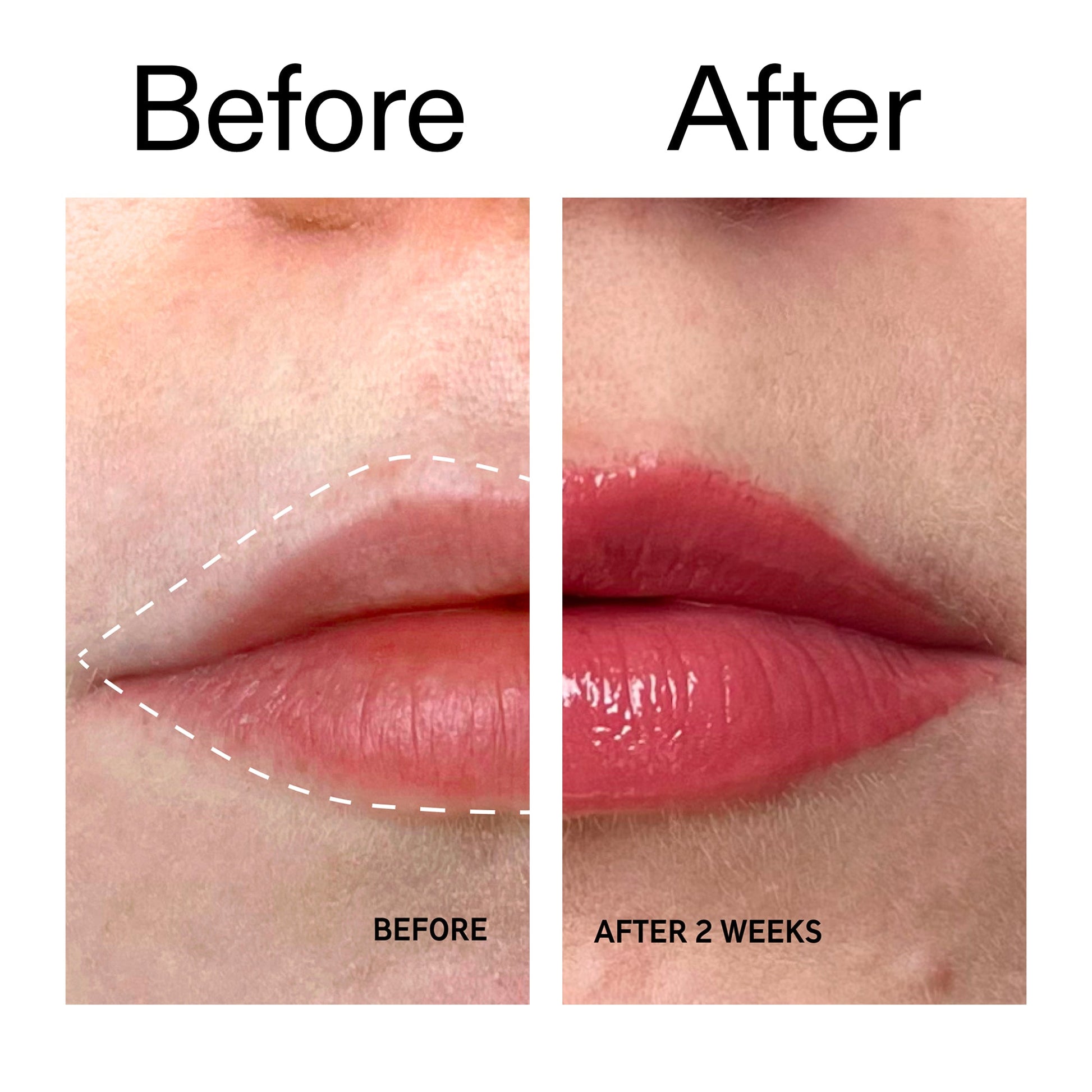 tripeptide-plumping-berry-lip-balm-a8 Tripeptide_Plumping_Lip_Balm_-_Berry_Before_After_2000x2000_9474bbd8-43ca-4b0e-b0e7-dfab70b91927.jpg