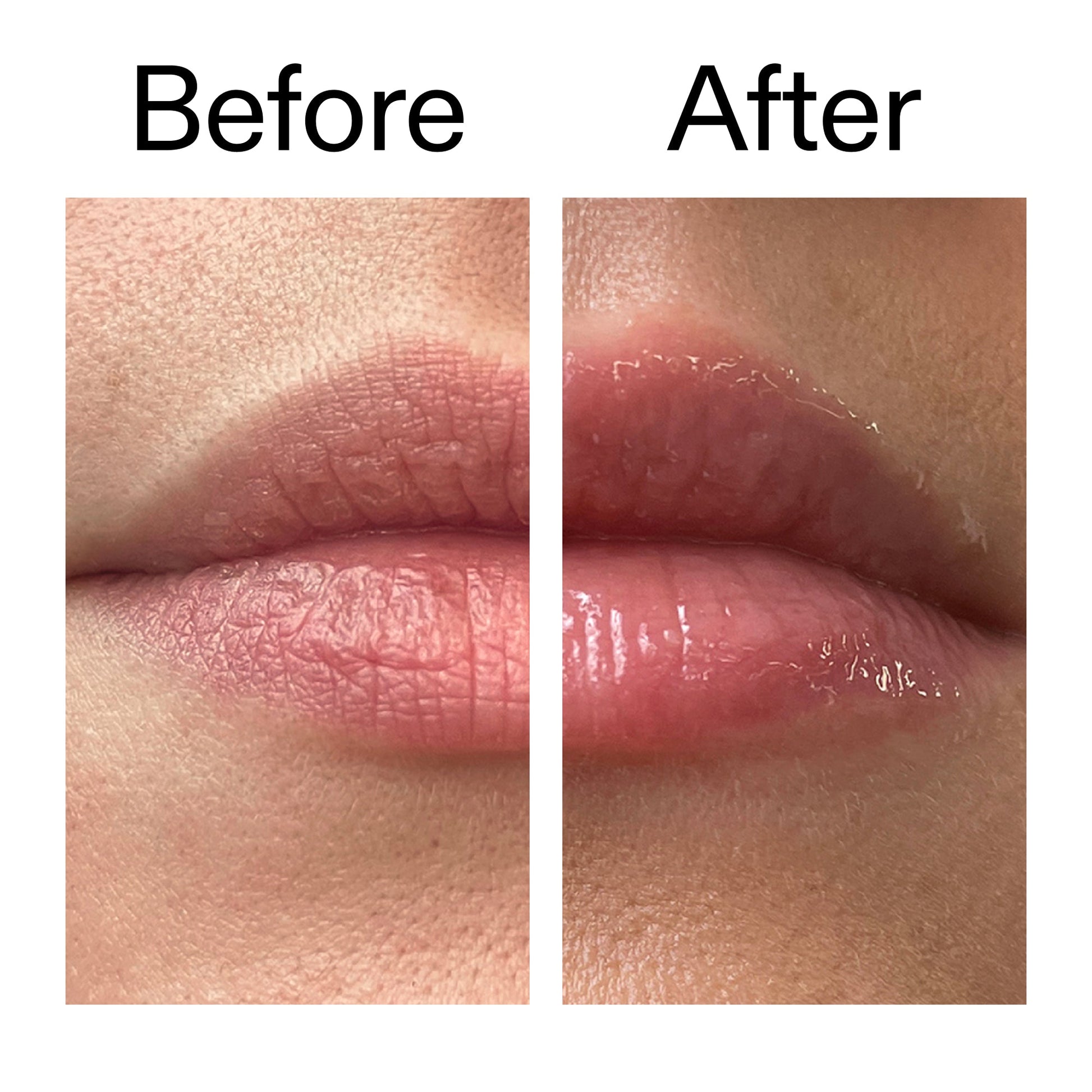 lip-plumping-duo-z5 Tripeptide_Plumping_Lip_Balm_Before_After_2000x2000_b4a5ee04-d2ac-4857-8f01-17209acc4bf3.jpg
