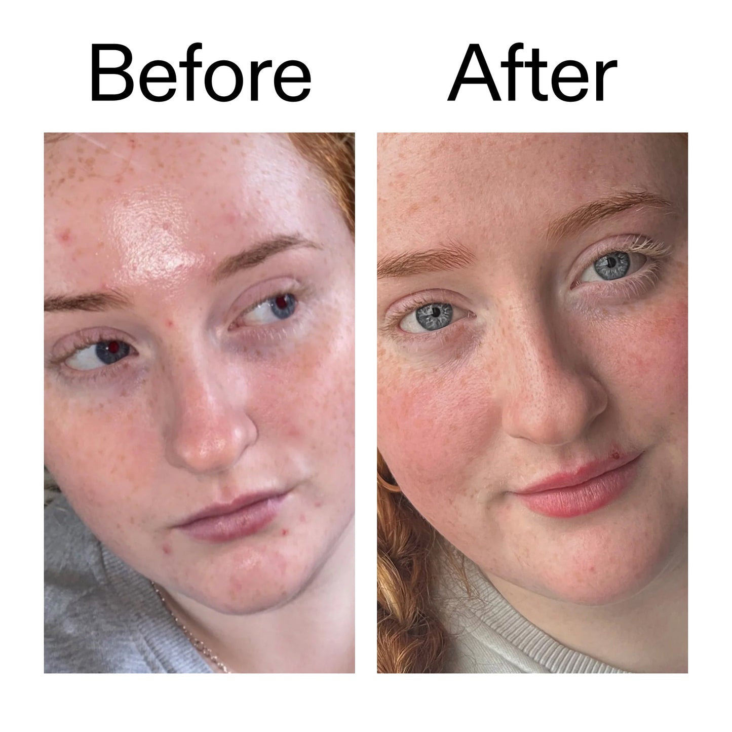 vitamin-b-c-and-e-moisturizer-e8 Vitamin_B_C_and_E_Moisturizer_Before_After_2000x2000_b0781a76-5ad2-4be9-95b8-ef92b356833c.jpg
